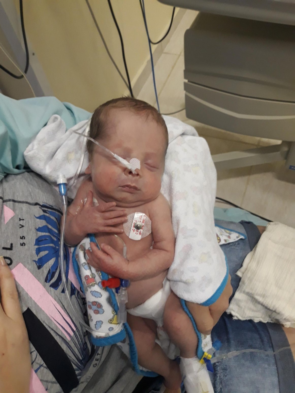 Miguel bebê durante a internação neonatal